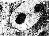 Шиповатый слой эпидермиса: ядро кератиноцита содержит 2 ядрышка